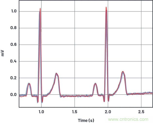 可穿戴市場喜迎生物醫學“多面手”
