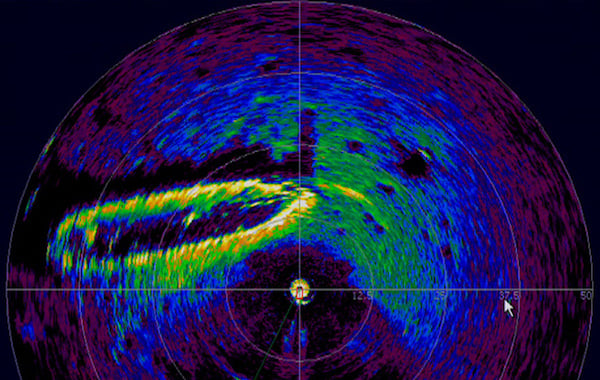 什么是激光雷達以及如何使用它? 什么是激光雷達以及如何使用它?