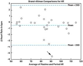 動(dòng)態(tài)離散周期變換技術(shù)突破：無ECG參考的生理信號精準(zhǔn)解析