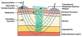 圖5.人體皮膚分層橫截面以及TMD和生物阻抗測量 考慮到生物阻抗分析的無創(chuàng)性,使用兩個金屬電極代表電氣傳感器,連接模擬前端(AFE)電路和患者皮膚。這個金屬與非金屬的接觸點是構(gòu)成整個電路的另一個關(guān)鍵部分,連接了AFE和人體電氣模型。電荷載體(電極中的電子和人體內(nèi)的離子)之間的相互作用可能對這些傳感器的性能產(chǎn)生重大影響,需要根據(jù)每種應(yīng)用進行具體考慮。首先,金屬與離子溶液接觸的相互作用導致金屬表面附近溶液中離子濃度的局部變化。這種現(xiàn)象會改變電極下方區(qū)域的電荷中性,導致金屬周圍的電解質(zhì)電位與溶液其余部分不同,從而在金屬和電解質(zhì)主體之間產(chǎn)生一個電位差,即常說的“半電池電位”。其次,注入電流的直流分量會導致電極極化。 表1.各種電極類型和相應(yīng)的半電池電位 金屬及反應(yīng) 半電池電位(V) Al → Al3+ + 3e- Al → Al3+ + 3e- –1.706 –1.706 Ni → Ni2+ + 2e- Ni → Ni2+ + 2e- –0.230 -0.230 H2 → 2H+ + 2e- H2 → 2H+ + 2e- 0.000 (by definition) 0.000(根據(jù)定義) Ag + Cl- → AgCl + e- Ag + Cl- → AgCl + e- +0.223 +0.223 Ag → Ag+ + e- Ag → Ag+ + e- +0.799 +0.799 Au → Au+ + e- Au → Au+ + e- +1.680 +1.680 這是一種不良現(xiàn)象,往往導致電極性能下降。這些考量表明,電極也需要定義適當?shù)碾姎饽P停▍⒁妶D6)。我們可以將干電極表示為具有三個串聯(lián)元件的電路:一個用于模擬半電池電位(EHC)的直流電源;一個用于模擬金屬和非金屬(人體)之間接觸的RC并聯(lián)電池(Rd||Cd);以及一個用于模擬電極金屬的電阻Rs。 圖5.人體皮膚分層橫截面以及TMD和生物阻抗測量 考慮到生物阻抗分析的無創(chuàng)性,使用兩個金屬電極代表電氣傳感器,連接模擬前端(AFE)電路和患者皮膚。這個金屬與非金屬的接觸點是構(gòu)成整個電路的另一個關(guān)鍵部分,連接了AFE和人體電氣模型。電荷載體(電極中的電子和人體內(nèi)的離子)之間的相互作用可能對這些傳感器的性能產(chǎn)生重大影響,需要根據(jù)每種應(yīng)用進行具體考慮。首先,金屬與離子溶液接觸的相互作用導致金屬表面附近溶液中離子濃度的局部變化。這種現(xiàn)象會改變電極下方區(qū)域的電荷中性,導致金屬周圍的電解質(zhì)電位與溶液其余部分不同,從而在金屬和電解質(zhì)主體之間產(chǎn)生一個電位差,即常說的“半電池電位”。其次,注入電流的直流分量會導致電極極化。 表1.各種電極類型和相應(yīng)的半電池電位 金屬及反應(yīng) 半電池電位(V) Al → Al3+ + 3e- Al → Al3+ + 3e- –1.706 –1.706 Ni → Ni2+ + 2e- Ni → Ni2+ + 2e- –0.230 -0.230 H2 → 2H+ + 2e- H2 → 2H+ + 2e- 0.000 (by definition) 0.000(根據(jù)定義) Ag + Cl- → AgCl + e- Ag + Cl- → AgCl + e- +0.223 +0.223 Ag → Ag+ + e- Ag → Ag+ + e- +0.799 +0.799 Au → Au+ + e- Au → Au+ + e- +1.680 +1.680 這是一種不良現(xiàn)象,往往導致電極性能下降。這些考量表明,電極也需要定義適當?shù)碾姎饽P停▍⒁妶D6)。我們可以將干電極表示為具有三個串聯(lián)元件的電路:一個用于模擬半電池電位(EHC)的直流電源;一個用于模擬金屬和非金屬(人體)之間接觸的RC并聯(lián)電池(Rd||Cd);以及一個用于模擬電極金屬的電阻Rs。